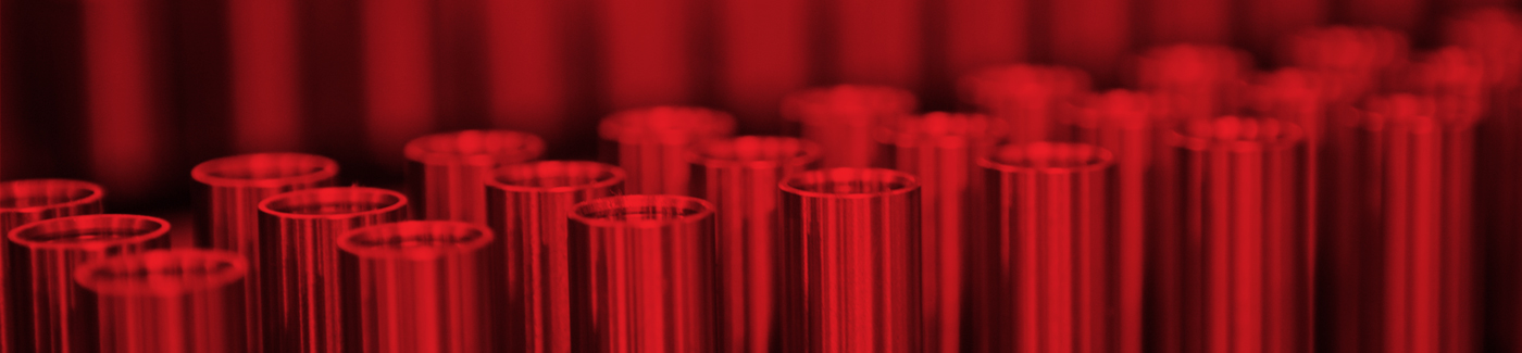 Supreme machining capabilities